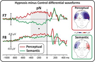 Now You See One Letter, Now You See Meaningless Symbols: Perceptual and Semantic Hypnotic Suggestions Reduce Stroop Errors Through Different Neurocognitive Mechanisms